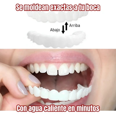 Carillas Dentales Snap On Smile