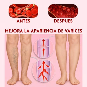 VenaBella Natural – Alivio y Renovación